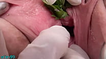 porn bigboyfuck nettles in peehole urethral insertion nettles fisting cunt free